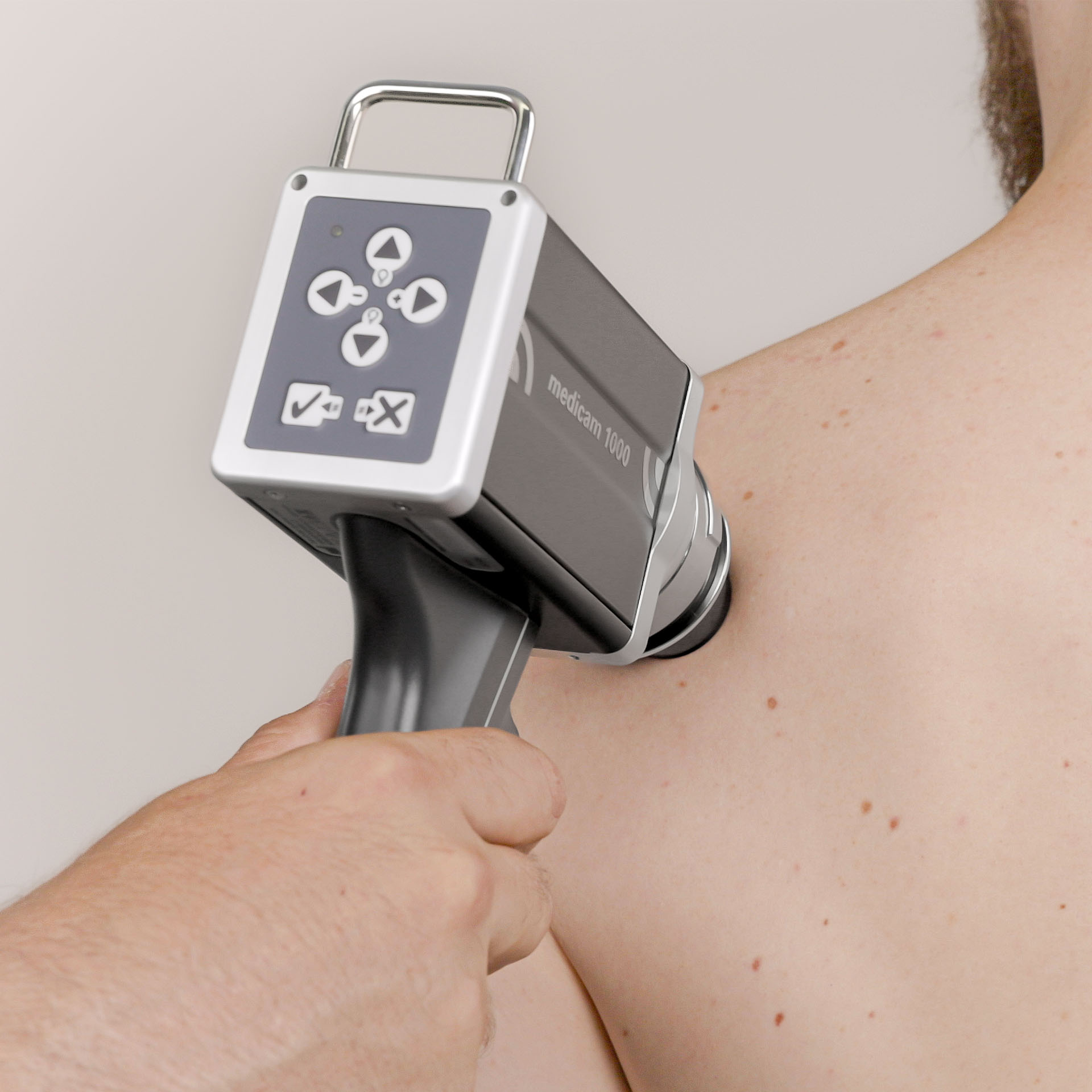 medicam 1000 em uso no exame da pele do ombro