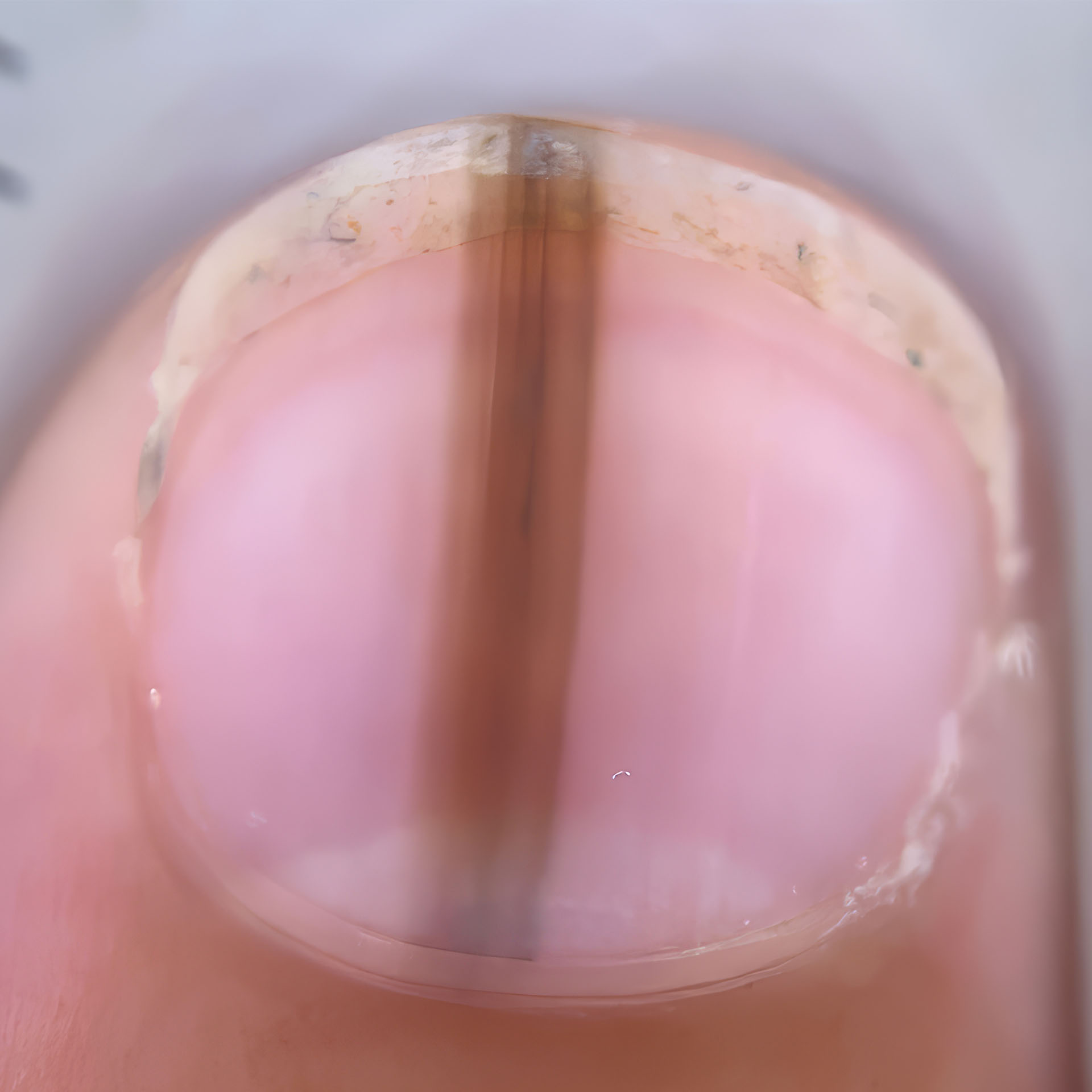 Imagem de onicoscopia de uma unha